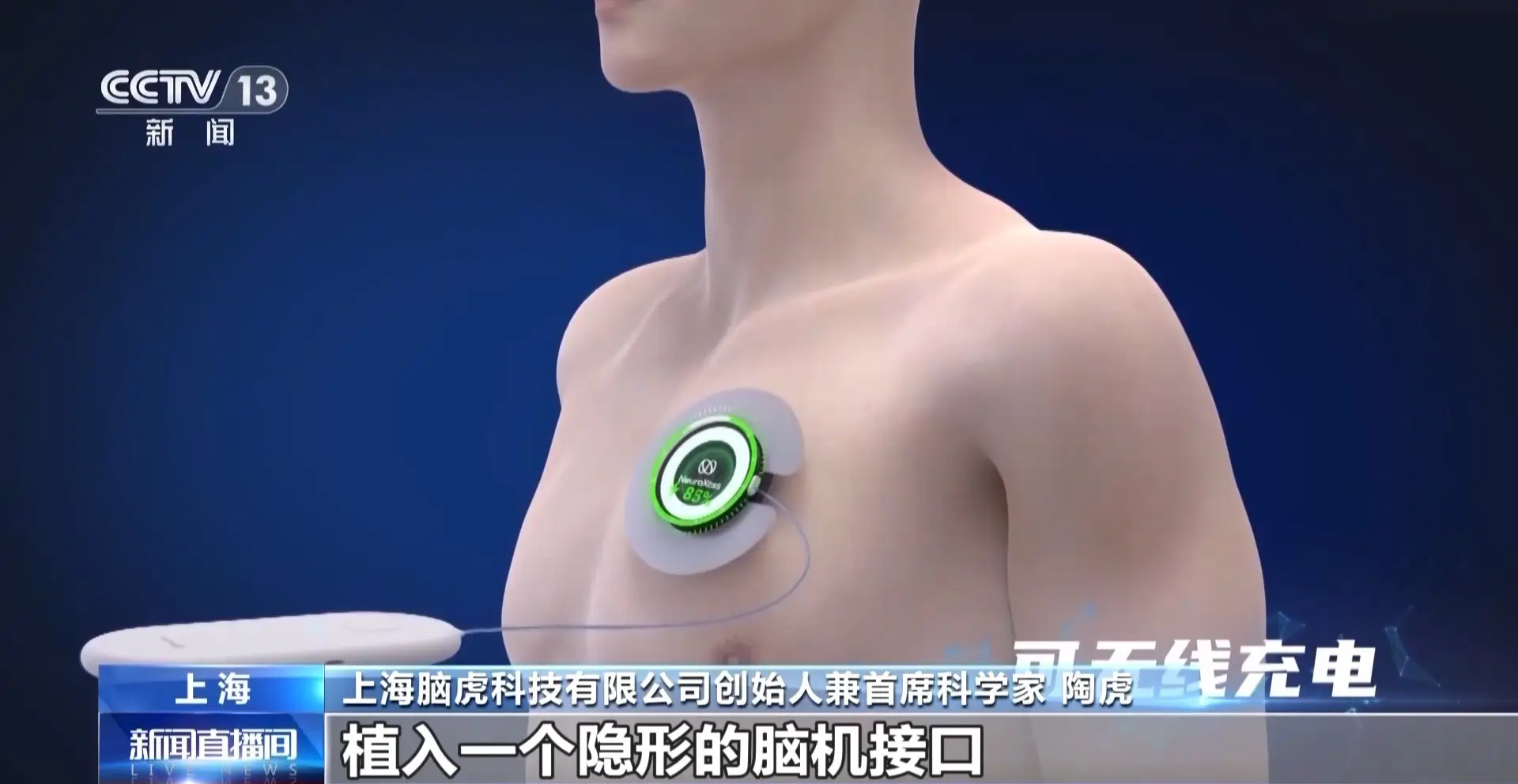 意念操控万物！国产脑机接口逆天突破，瘫痪患者“隔空”打游戏 -1