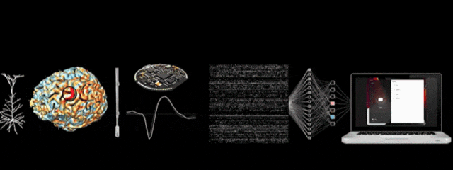 Neuralink新视频炸场：手术快如闪电，万人排队等“开颅”？ -1