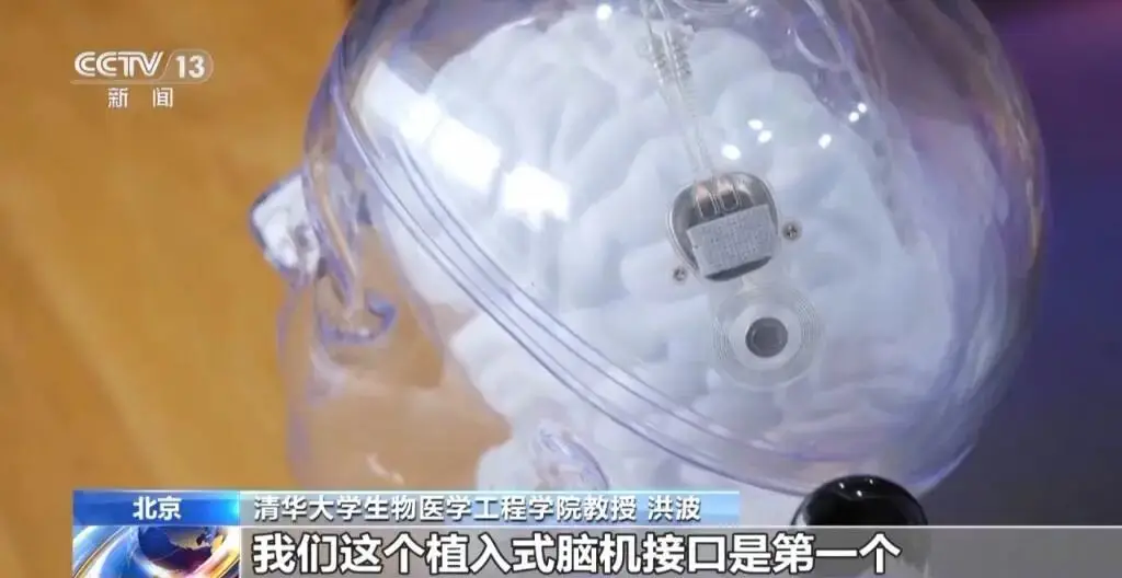 瘫痪患者亲手抓豆写字!中国脑机接口实现全球首发“奇迹” -1 瘫痪患者亲手抓豆写字!中国脑机接口实现全球首发“奇迹” -1